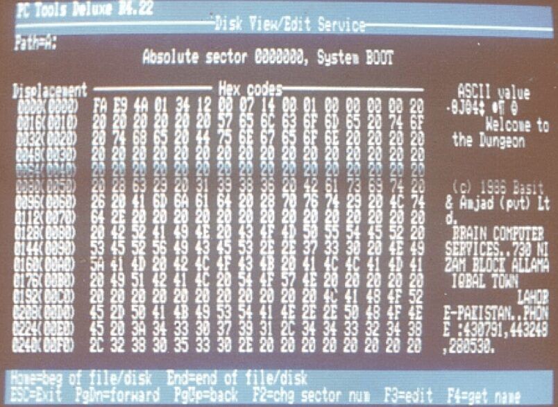 Figure 3 – Brain boot virus